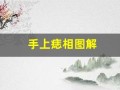 手上痣相图解