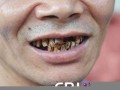 梦见掉牙齿(梦见掉牙齿是什么意思 男人)